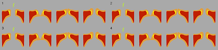 Stroboskopische Beleuchtung der Stimmlippen immer derselben Phase in jedem Schwingungszyklus